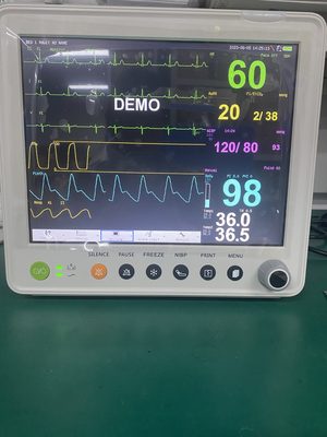 Monitor paciente portátil con parámetros de las RRPP de los TEMPOREROS de ETCO2 ECG NIBP SPO2 RESP