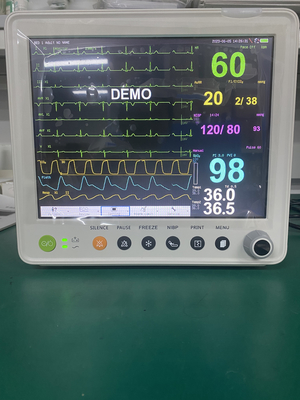 Monitor paciente médico de 12,1 pulgadas del equipo del hospital con multiparámetros del CO2