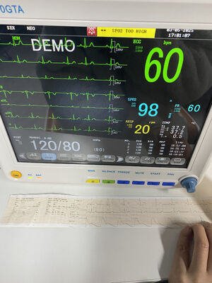 Monitoreo portátil junto a la cama con ECG SPO2 NIBP TEMP RESP Opcional ETCO2-clase II 1 año de garantía
