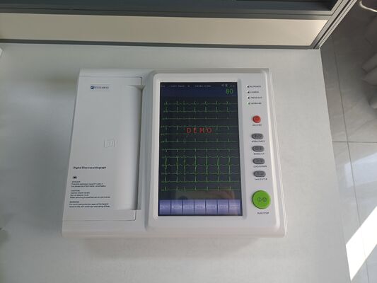 Electrocardiógrafo Portátil de 12 Canales con Pantalla Táctil a Color de 10.2" y Batería Integrada